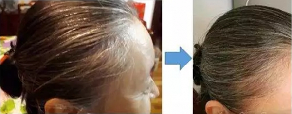 诗碧曼